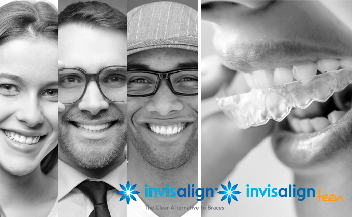Invisalign