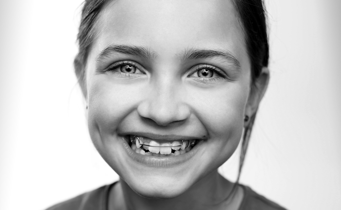 How old for braces