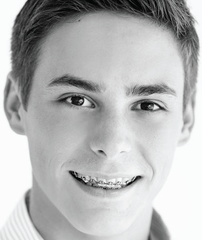 Smile gallery