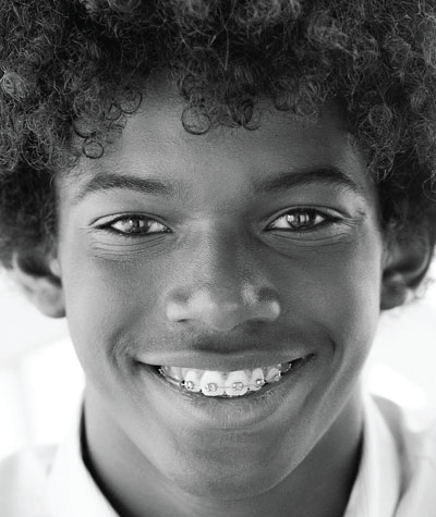 Smile gallery