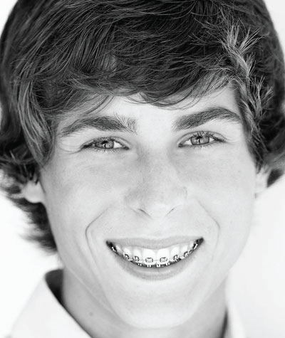 Smile gallery
